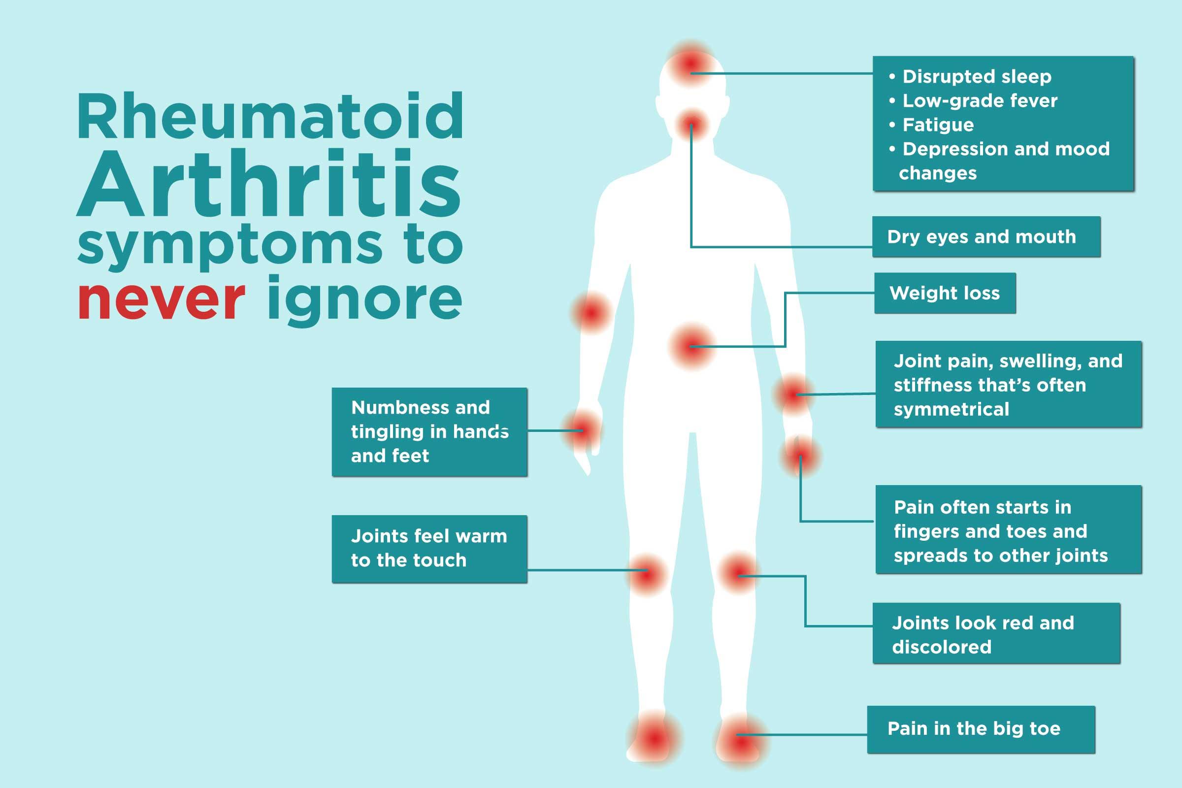 Rheumatoid Arthritis: Symptoms and Treatment
