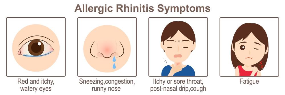 Allergic Rhinitis: Symptoms and Treatment